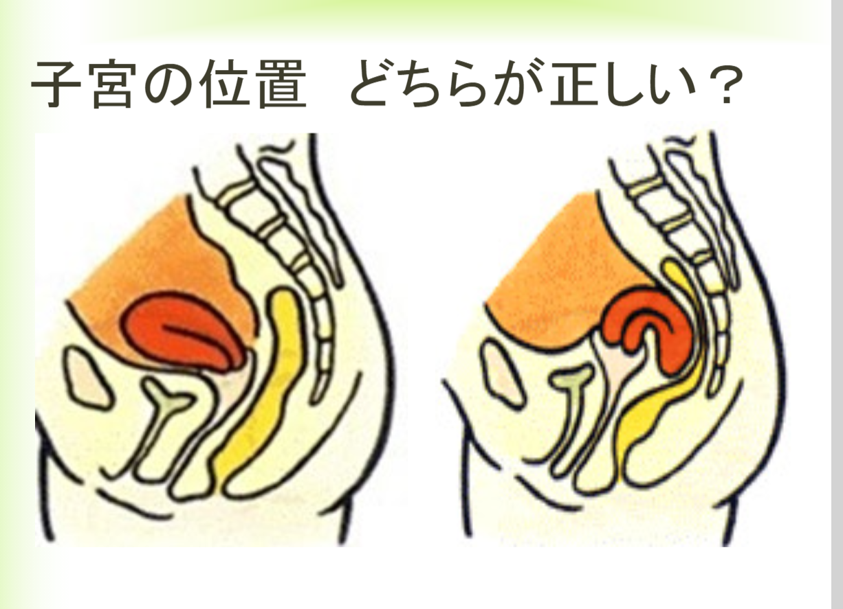 どっちが正しい?