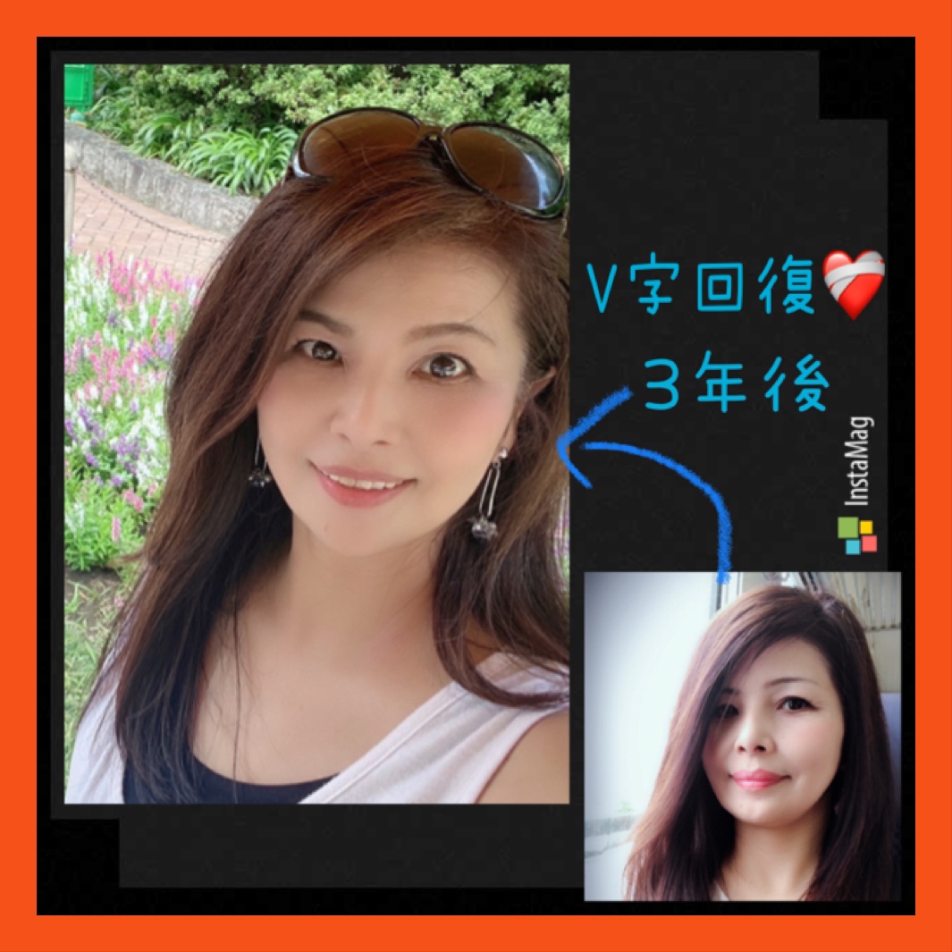 50代でも変化します。